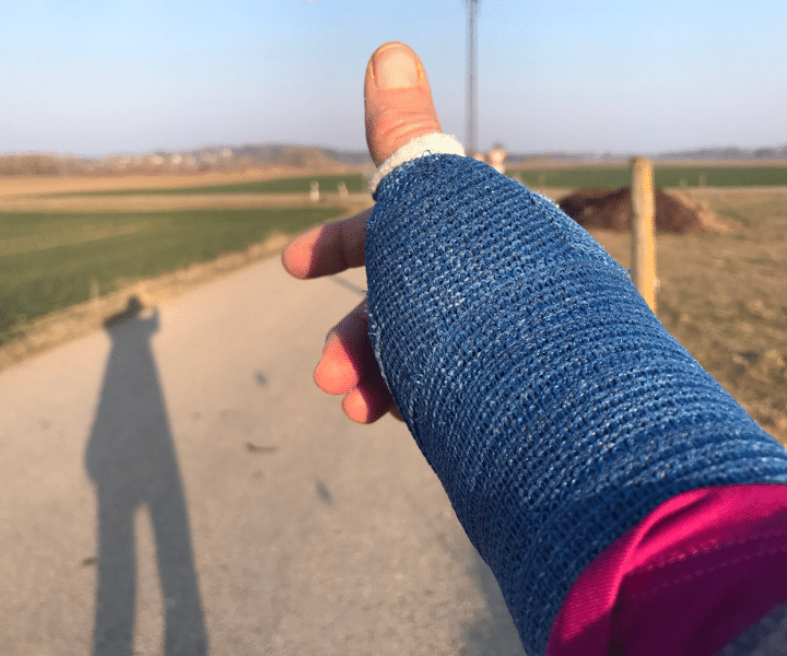 broken arm in a blue cast